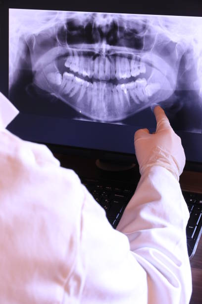 Best Emergency Dentist for Knocked-Out Tooth in Silver Grove, KY